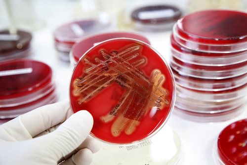 Centers for Disease Control and Prevention