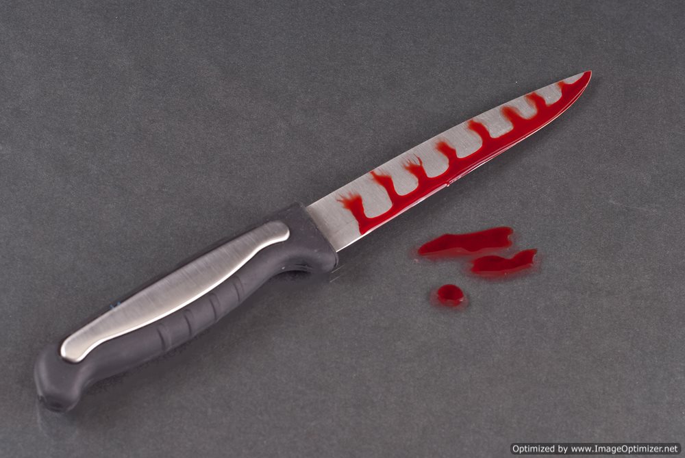 Woman Chops-Off Husband’s Penis