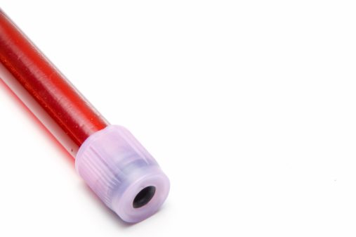Understanding Blood Tests for BAC