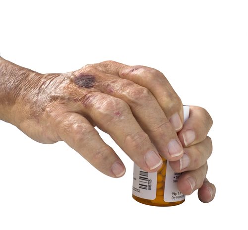 Xeljanz Approved for Rheumatoid Arthritis